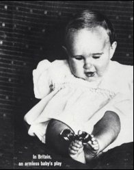 In Britain, an armless baby's play. Life article on thalidomide.